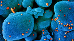Photo courtesy of NIH and NIAID