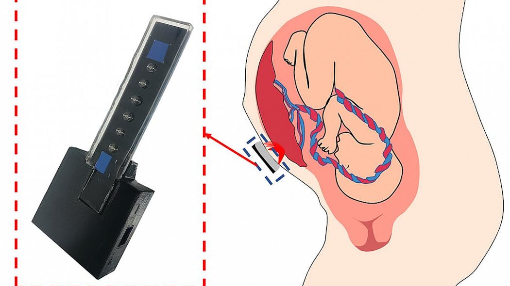 Prototype Device May Diagnose Pregnancy Complications By Monitoring Placental Oxygen Pic 6 21 21du 202106147 Nichd Oxygenation Nih + Nichd