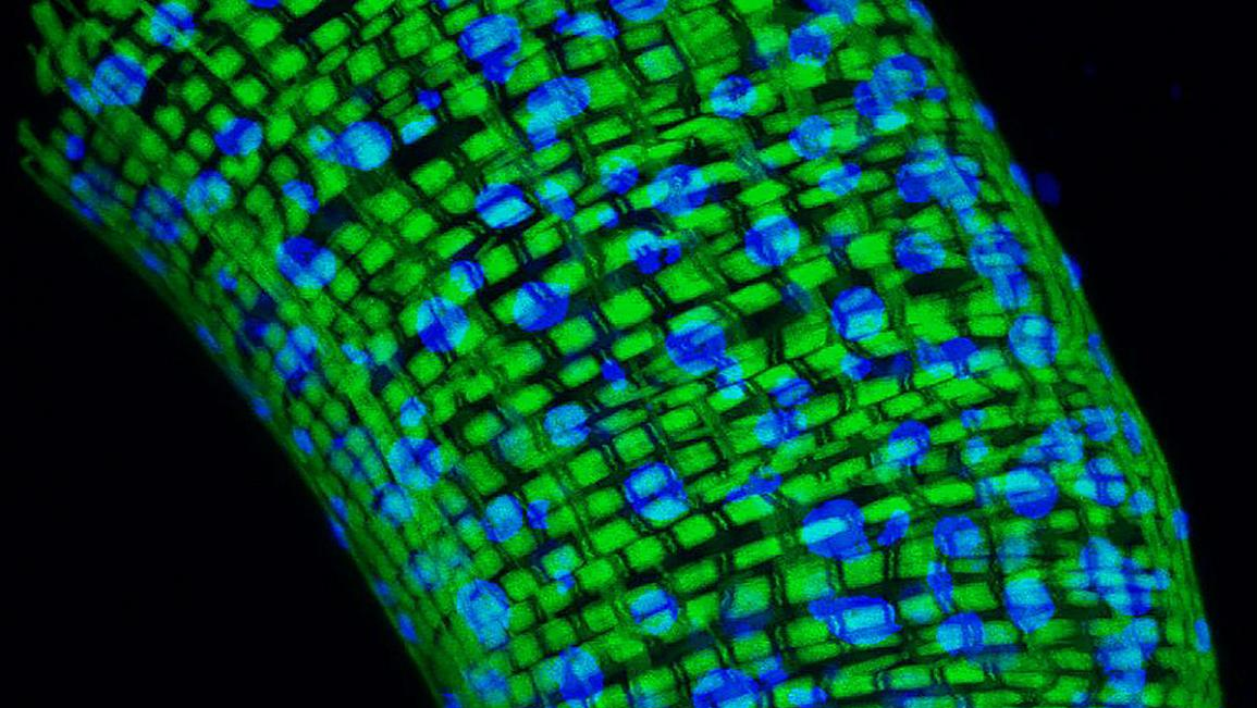 Photo courtesy of NIH and NINDS