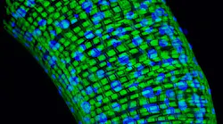 Photo courtesy of NIH and NINDS