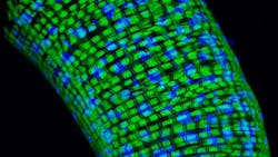 Photo courtesy of NIH and NINDS Photo courtesy of NIH and NINDS