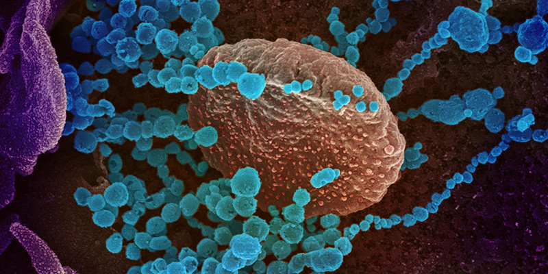 Photo courtesy of NIAID/NIH