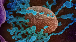 Photo courtesy of NIAID/NIH