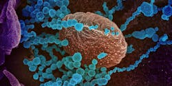 Photo courtesy of NIAID/NIH Photo courtesy of NIAID/NIH