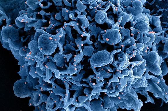 Photo courtesy of NIH