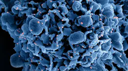Photo courtesy of NIH
