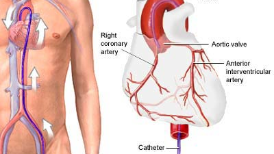 Photo courtesy of NIH U.S. National Library of Medicine Medline Plus