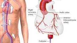 Photo courtesy of NIH U.S. National Library of Medicine Medline Plus Photo courtesy of NIH U.S. National Library of Medicine Medline Plus