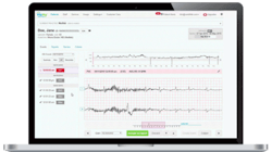 Photo courtesy of InfoBionic Photo courtesy of InfoBionic