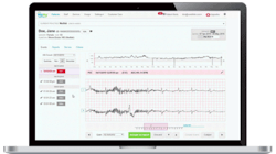 Photo courtesy of InfoBionic Photo courtesy of InfoBionic