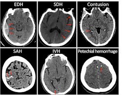 20210719 Brain 60f6efb8ad33e 20210719 Brain 60f6efb8ad33e