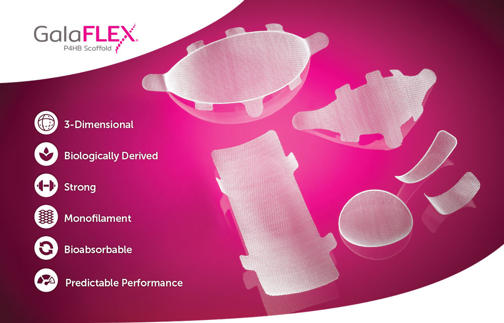 Gala Flex 1 6101723681cfe