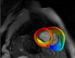 Johns Hopkins University 6103059ee1170 Johns Hopkins University 6103059ee1170