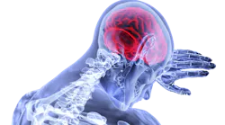 Brain 3168269 1920