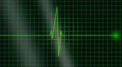 Electrocardiogram 36732 1280