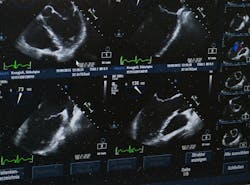 Ultrasound 509396 1920 610aaf51463a4 Ultrasound 509396 1920 610aaf51463a4