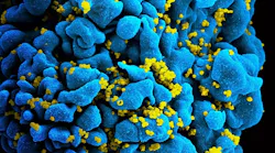 9 1 Hiv Nih