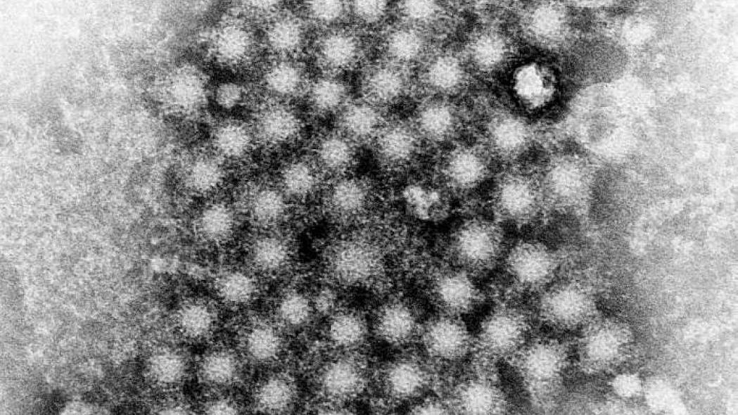 A transmission electron microscopic image of hepatitis virus particles CDC/ E.H. Cook, Jr.
