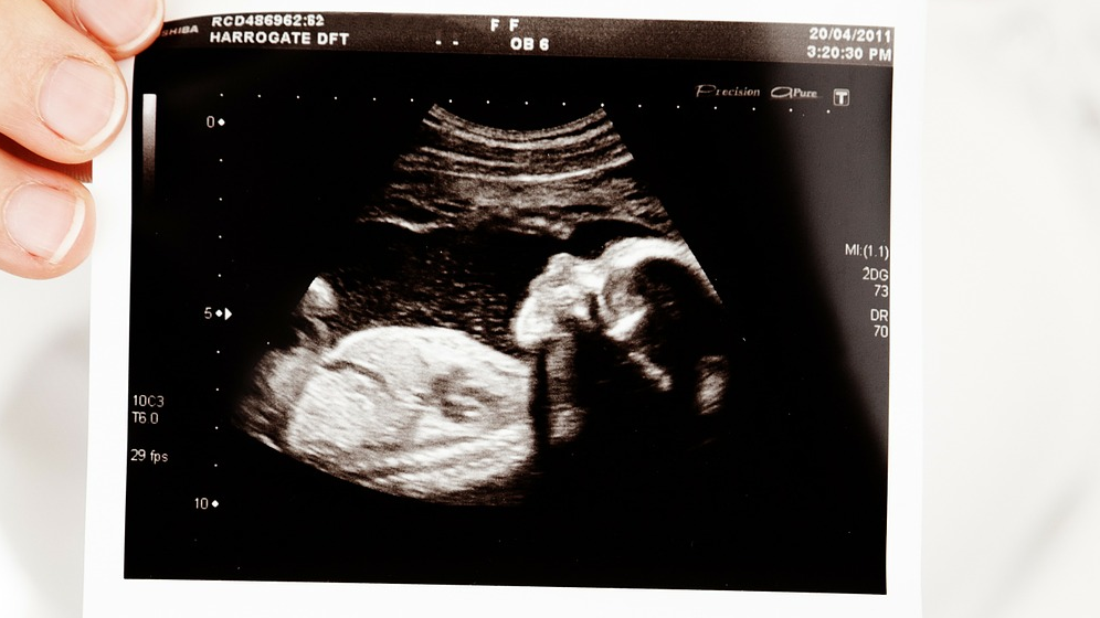 Baby 18937 1920 6140b1d65bfa2