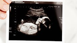 Baby 18937 1920 6140b1d65bfa2 Baby 18937 1920 6140b1d65bfa2