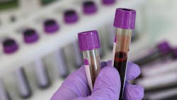 Laboratory 3827736 1920 6130d7562d177 Laboratory 3827736 1920 6130d7562d177