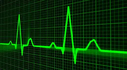 Pulse Trace 163708 1280