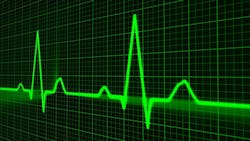 Pulse Trace 163708 1280 61433e71cc4d6 Pulse Trace 163708 1280 61433e71cc4d6