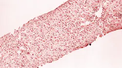 Courtesy of CDC