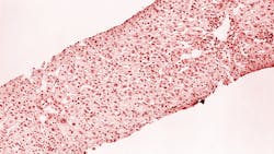 Courtesy of CDC Courtesy of CDC