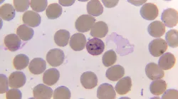 Courtesy of CDC