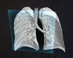 Dicom Director’s Intravision XR hologram Dicom Director’s Intravision XR hologram