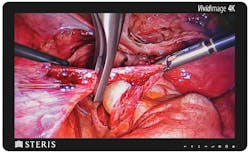 STERIS Vividimage 4K 31.1' Ultra High-Definition Surgical Display STERIS Vividimage 4K 31.1' Ultra High-Definition Surgical Display