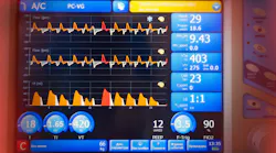Patient Monitor Image By Alexey Fedenkov From Pixabay
