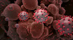 Courtesy of NIH