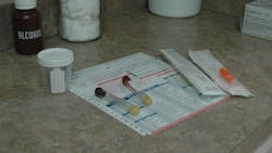 Blood Test Gbe2091135 1920 618d449387995 Blood Test Gbe2091135 1920 618d449387995