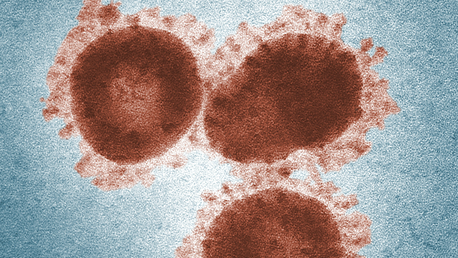 Pexels Cdc 3992945 618d412dc022f