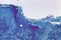 Courtesy of CDC Courtesy of CDC