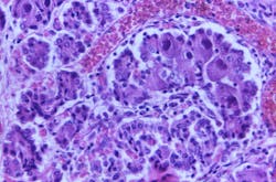 Courtesy of CDC Courtesy of CDC