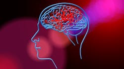 Stroke Gad8072a05 1920 61c08bcb27581 Stroke Gad8072a05 1920 61c08bcb27581