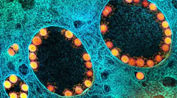 Transmission electron micrograph of SARS-CoV-2 virus particles (gold) within endosomes of a heavily infected nasal Olfactory Epithelial Cell.NIAID