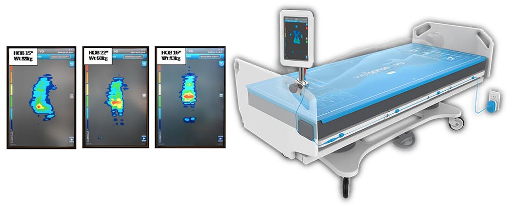 Wellsense V&Umacr; advanced pressure visualization system