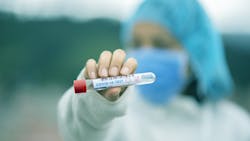 Test Tube 5065425 1920 61f16ef256199 Test Tube 5065425 1920 61f16ef256199