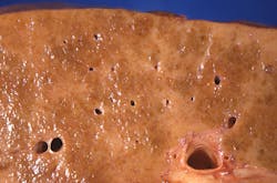 Courtesy of CDC Courtesy of CDC