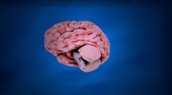 Brain G2324d2807 1280