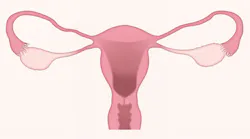Uterus 3777765 1920