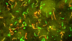 Courtesy of CDC Courtesy of CDC