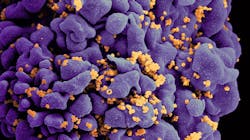 Scanning electron micrograph of an HIV-infected H9 T cell, colorized in Halloween colors. NIAID. Scanning electron micrograph of an HIV-infected H9 T cell, colorized in Halloween colors. NIAID.