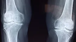 Knee Ge4ec6753c 1920