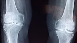 Knee Ge4ec6753c 1920 623b238948557 Knee Ge4ec6753c 1920 623b238948557