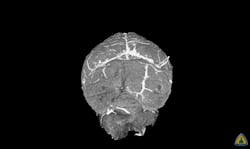 Courtesy of Johns Hopkins Courtesy of Johns Hopkins